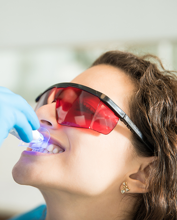 Teeth Whitening