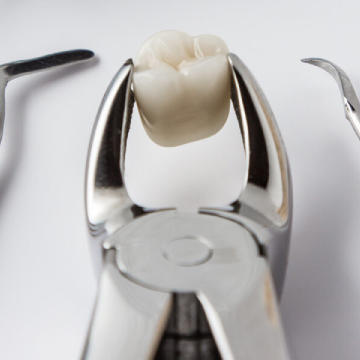 Tooth Extractions