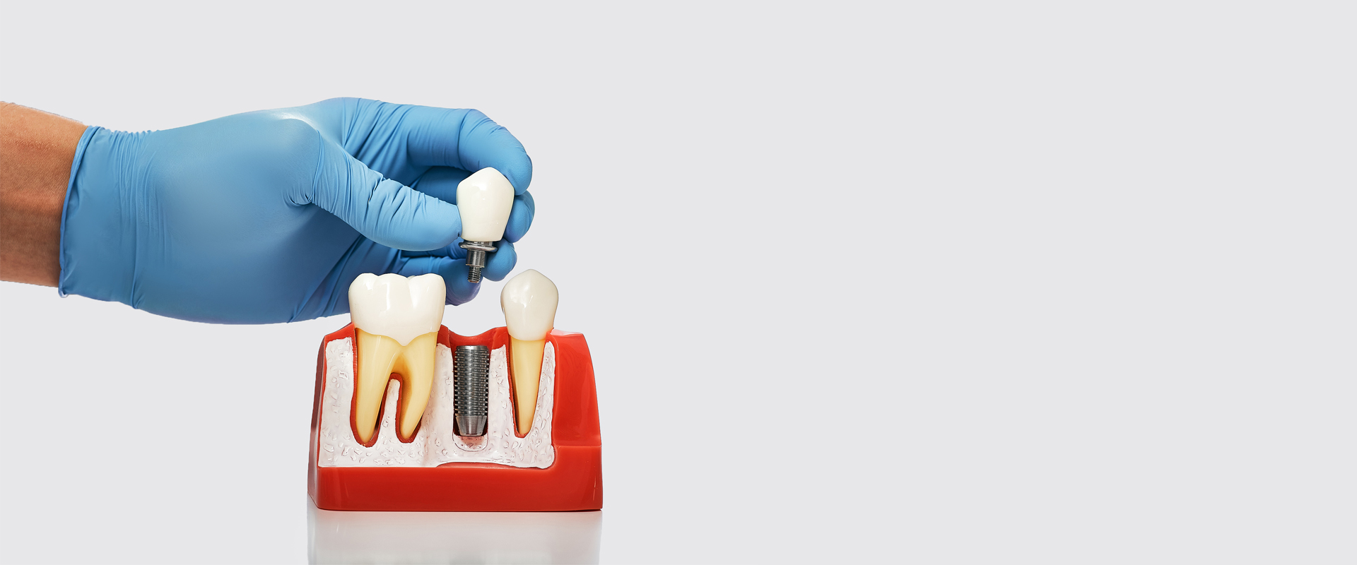 Same-Day Emergency Dentistry