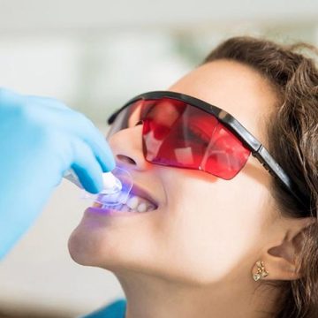Teeth Whitening in Cedar Park, TX, Teeth Whitening near me
