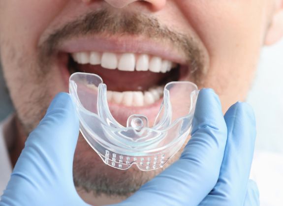 Mouth Guards in Cedar Park, TX
